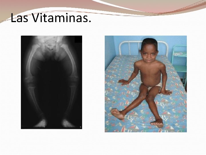 Las Vitaminas. 