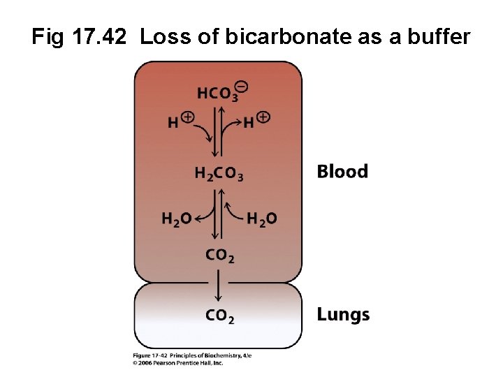 Fig 17. 42 Loss of bicarbonate as a buffer 