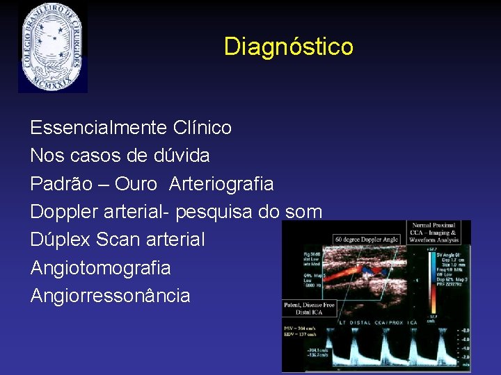 Diagnóstico Essencialmente Clínico Nos casos de dúvida Padrão – Ouro Arteriografia Doppler arterial- pesquisa