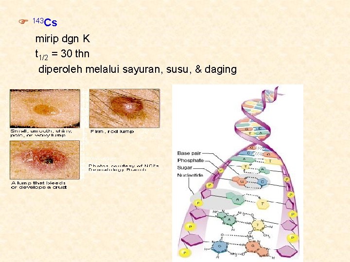  143 Cs mirip dgn K t 1/2 = 30 thn diperoleh melalui sayuran,