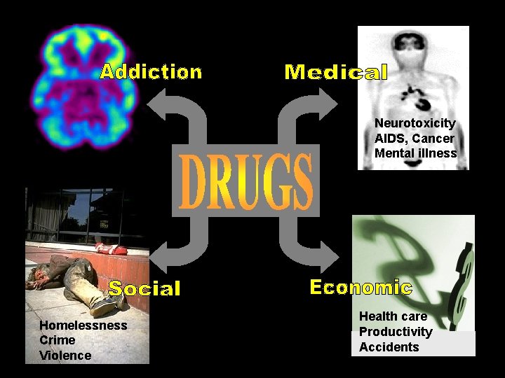 Neurotoxicity AIDS, Cancer NEUROTOXICITY AIDSMental illness CANCER MENTAL ILLNESS Homelessness Crime Violence Health care