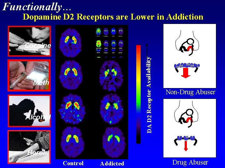 Functionally… Dopamine D 2 Receptors are Lower in Addiction Cocaine DA D 2 Receptor