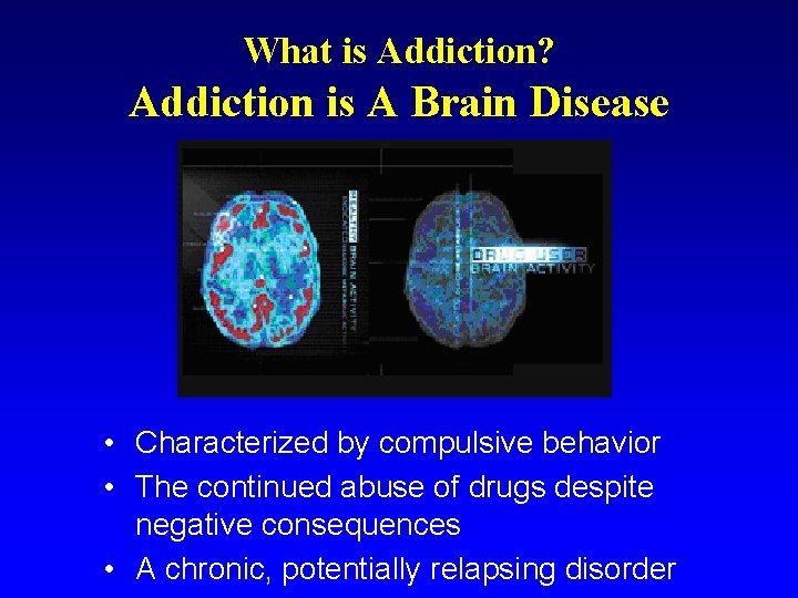 What is Addiction? Addiction is A Brain Disease • Characterized by compulsive behavior •