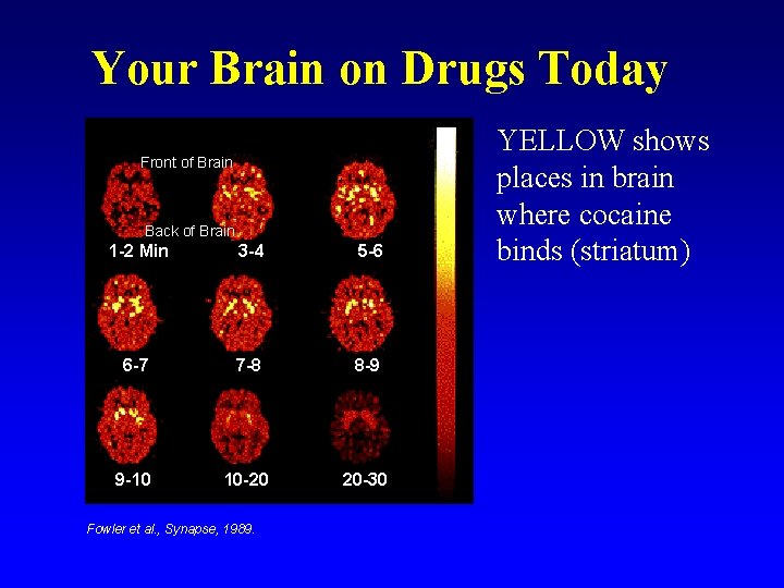 Your Brain on Drugs Today Front of Brain Back of Brain 1 -2 Min