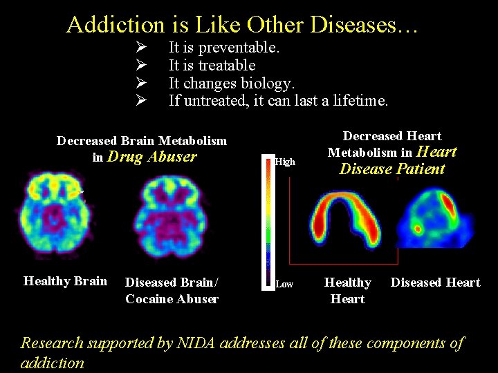 Addiction is Like Other Diseases… Ø Ø It is preventable. It is treatable It