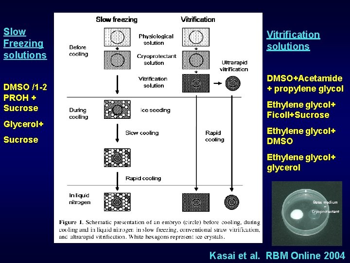 Slow Freezing solutions DMSO /1 -2 PROH + Sucrose Glycerol+ Sucrose Vitrification solutions DMSO+Acetamide