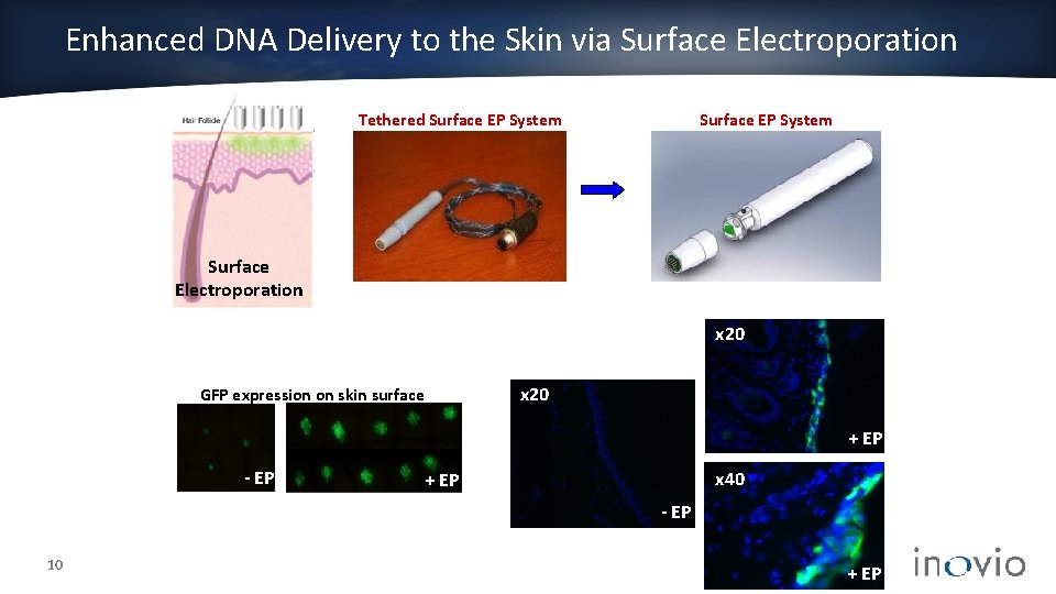 Enhanced DNA Delivery to the Skin via Surface Electroporation Tethered Surface EP System Surface