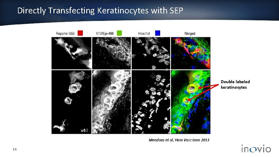 Directly Transfecting Keratinocytes with SEP Double labeled keratinocytes x 40 Mendoza et al, Hum