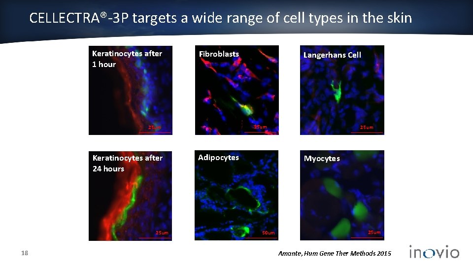 CELLECTRA®-3 P targets a wide range of cell types in the skin Keratinocytes after