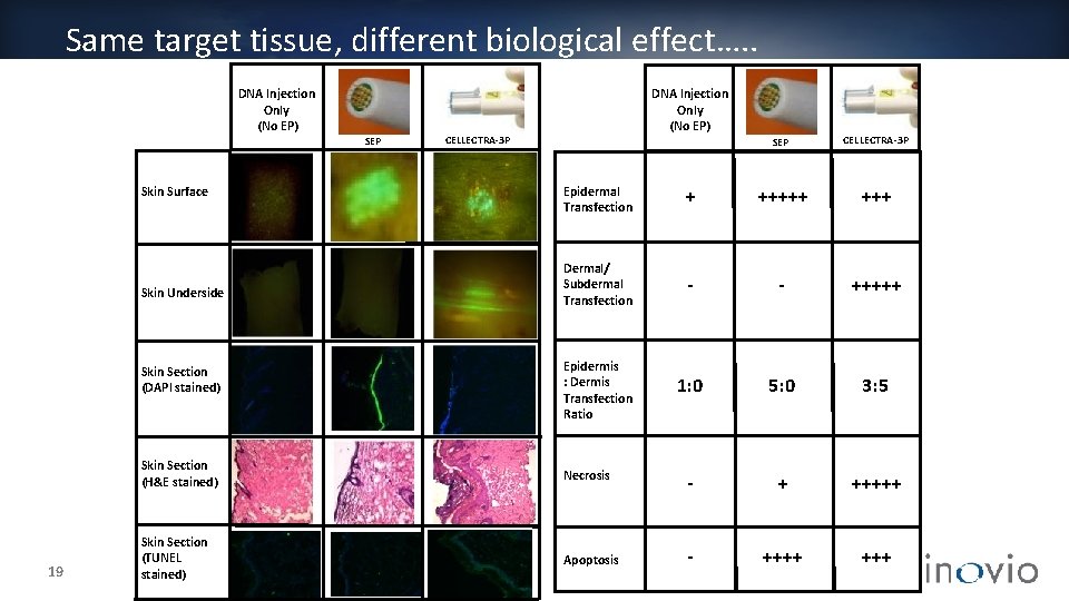 Same target tissue, different biological effect…. . DNA Injection Only (No EP) SEP CELLECTRA-3