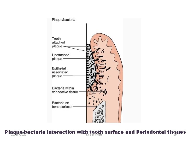 Plaque-bacteria interaction with. Dr Saif Khan tooth surface and Periodontal tissues 10/28/2020 16 