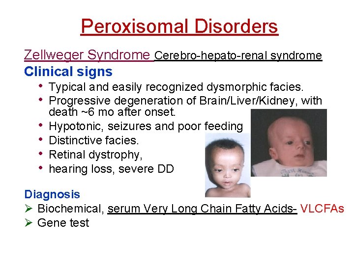 Peroxisomal Disorders Zellweger Syndrome Cerebro-hepato-renal syndrome Clinical signs • Typical and easily recognized dysmorphic