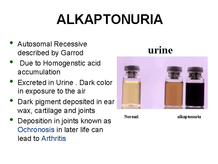 ALKAPTONURIA • • • Autosomal Recessive described by Garrod Due to Homogenstic acid accumulation