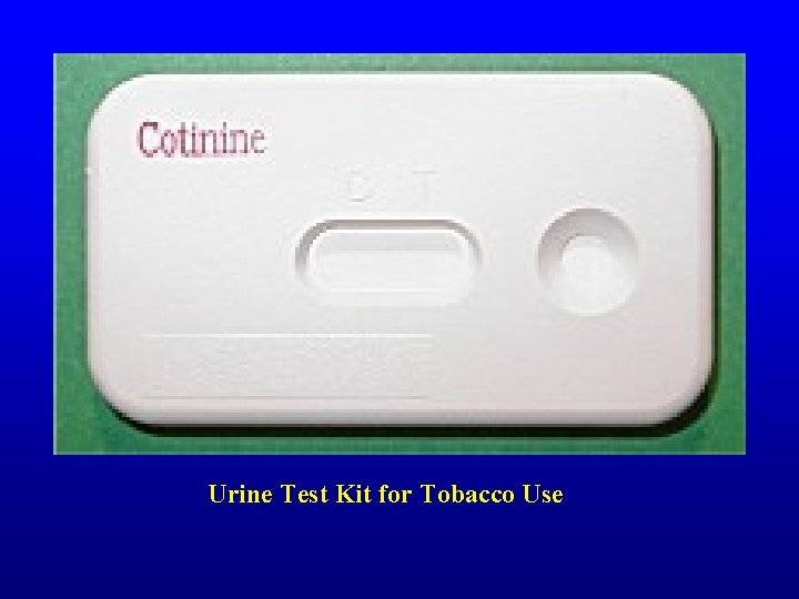 Urine Test Kit for Tobacco Use 