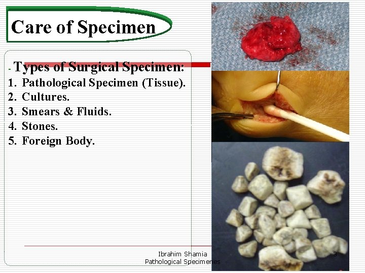 Care of Specimen - Types 1. 2. 3. 4. 5. of Surgical Specimen: Pathological