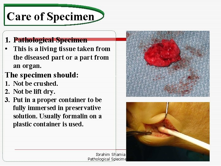 Care of Specimen 1. Pathological Specimen • This is a living tissue taken from