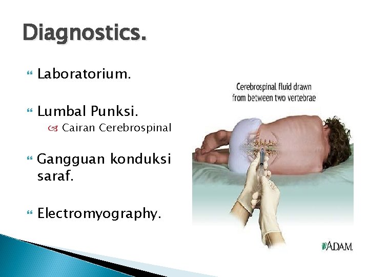 Diagnostics. Laboratorium. Lumbal Punksi. Cairan Cerebrospinal Gangguan konduksi saraf. Electromyography. 