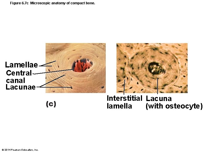 Figure 6. 7 c Microscopic anatomy of compact bone. Lamellae Central canal Lacunae Interstitial