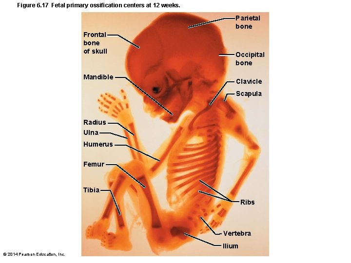 Figure 6. 17 Fetal primary ossification centers at 12 weeks. Parietal bone Frontal bone