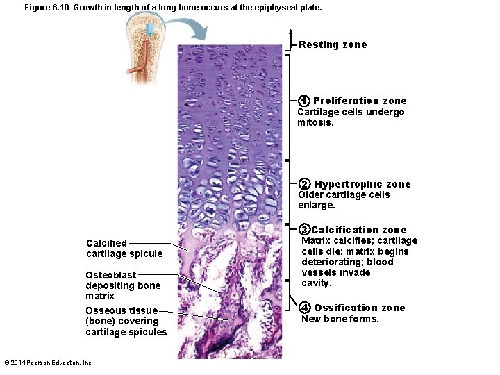 Figure 6. 10 Growth in length of a long bone occurs at the epiphyseal