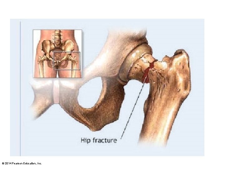 © 2014 Pearson Education, Inc. 