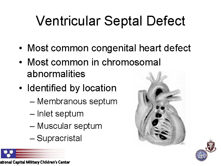 Ventricular Septal Defect • Most common congenital heart defect • Most common in chromosomal