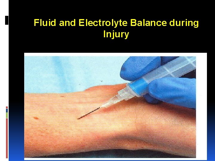 Fluid and Electrolyte Balance during Injury 