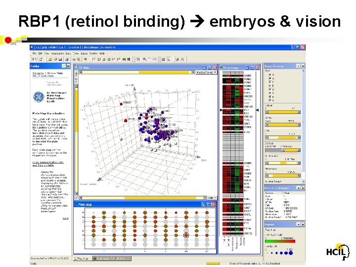 RBP 1 (retinol binding) embryos & vision 