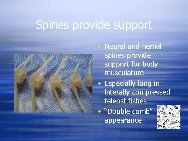 Spines provide support w Neural and hemal spines provide support for body musculature w