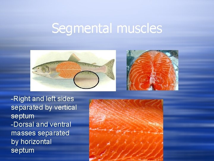 Segmental muscles -Right and left sides separated by vertical septum -Dorsal and ventral masses