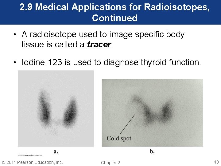 2. 9 Medical Applications for Radioisotopes, Continued • A radioisotope used to image specific