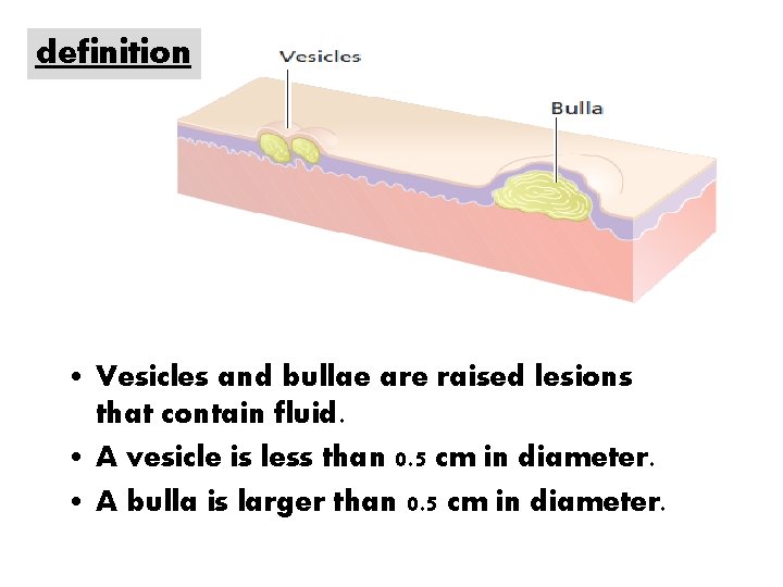definition • Vesicles and bullae are raised lesions that contain fluid. • A vesicle