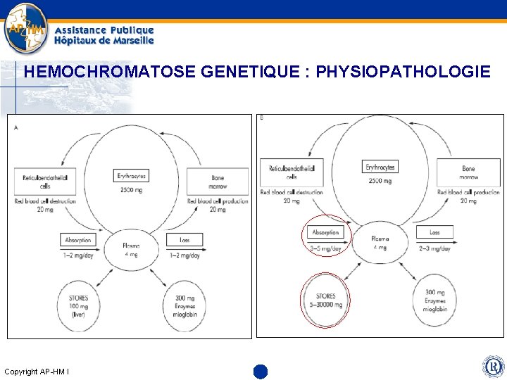 HEMOCHROMATOSE GENETIQUE : PHYSIOPATHOLOGIE Copyright AP-HM l 