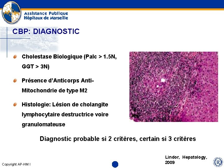 CBP: DIAGNOSTIC Cholestase Biologique (Palc > 1. 5 N, GGT > 3 N) Présence