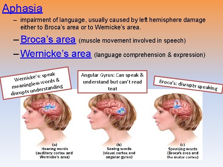 Aphasia – impairment of language, usually caused by left hemisphere damage either to Broca’s