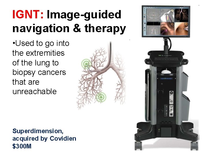 IGNT: Image-guided navigation & therapy • Used to go into the extremities of the