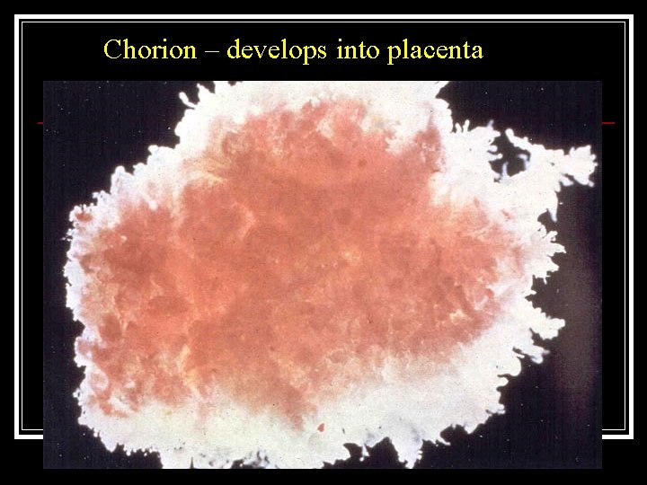 Chorion – develops into placenta 