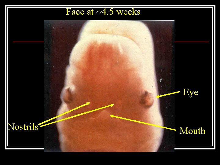 Face at ~4. 5 weeks Eye Nostrils Mouth 