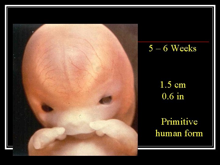 5 – 6 Weeks 1. 5 cm 0. 6 in Primitive human form 