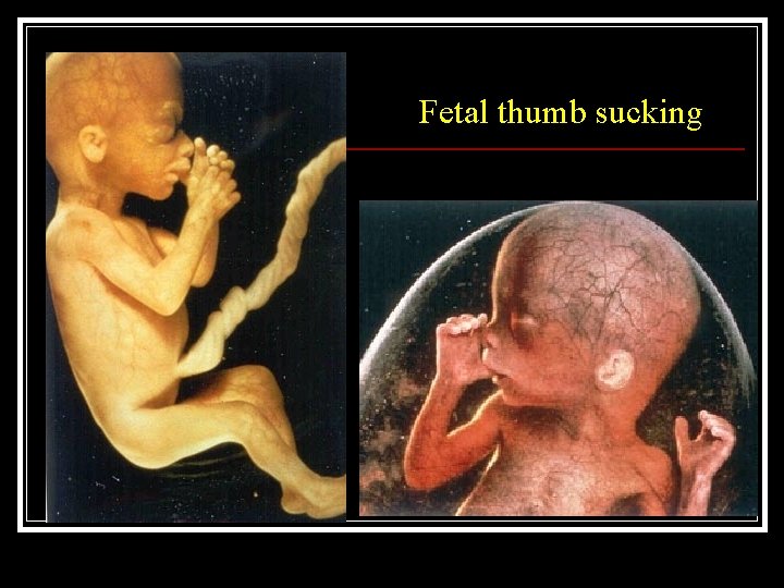 Fetal thumb sucking 