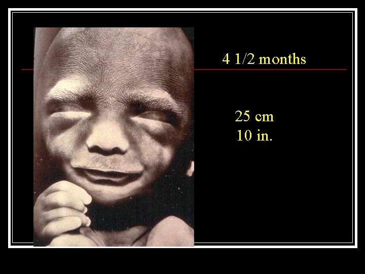 4 1/2 months 25 cm 10 in. 