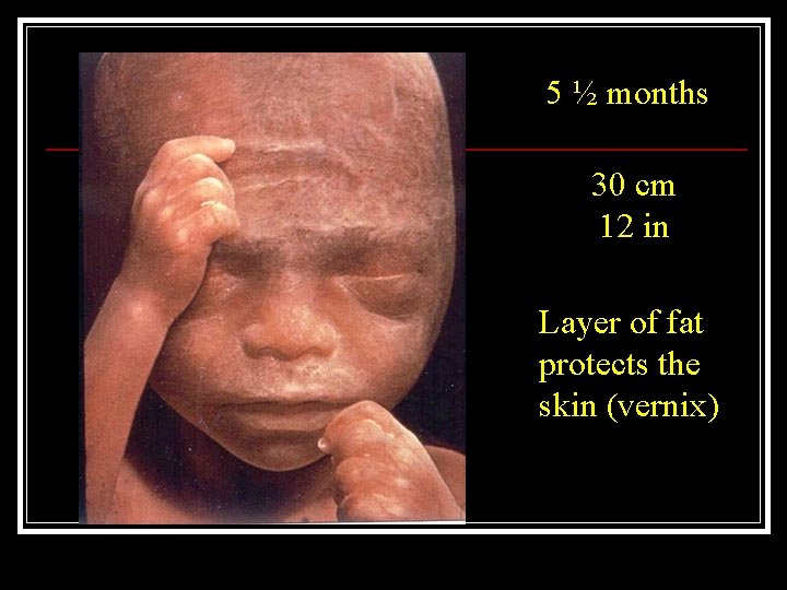 5 ½ months 30 cm 12 in Layer of fat protects the skin (vernix)