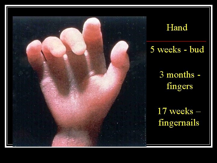 Hand 5 weeks - bud 3 months fingers 17 weeks – fingernails 