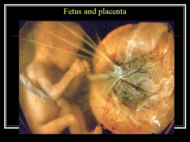 Fetus and placenta 