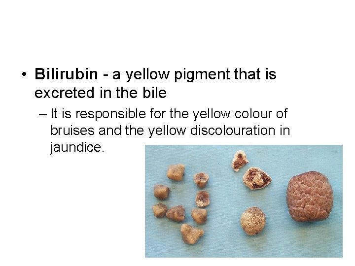  • Bilirubin - a yellow pigment that is excreted in the bile –