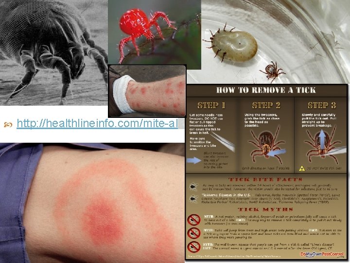  http: //healthlineinfo. com/mite-allergy. html 