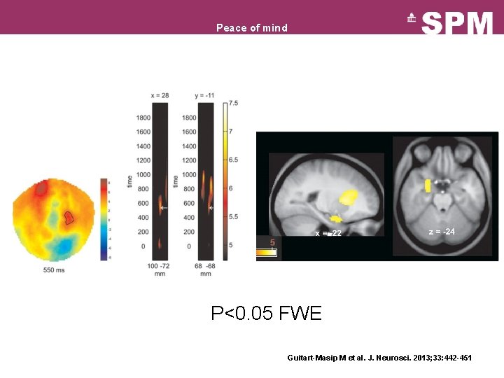 Peace of mind P<0. 05 FWE Guitart-Masip M et al. J. Neurosci. 2013; 33: