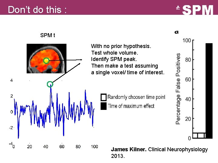 Don’t do this : SPM t With no prior hypothesis. Test whole volume. Identify