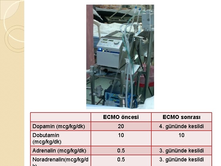 ECMO öncesi ECMO sonrası Dopamin (mcg/kg/dk) 20 4. gününde kesildi Dobutamin (mcg/kg/dk) 10 10