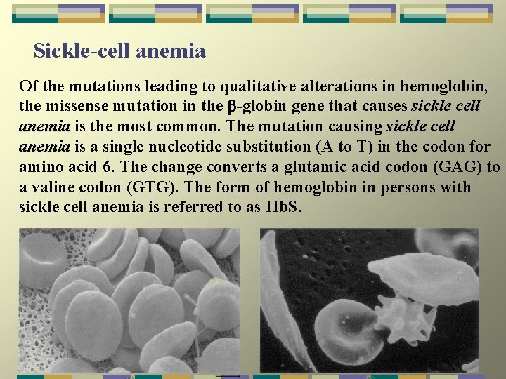 Sickle-cell anemia Of the mutations leading to qualitative alterations in hemoglobin, the missense mutation